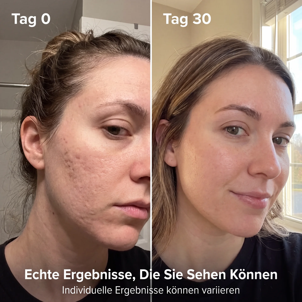 ClaraVive Collagen Bloom